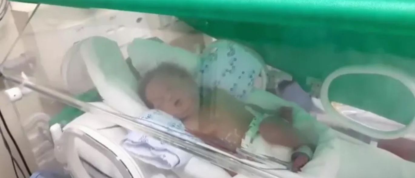 Derrubado por enfermeira, bebê esperou 4h para atendimento, diz família