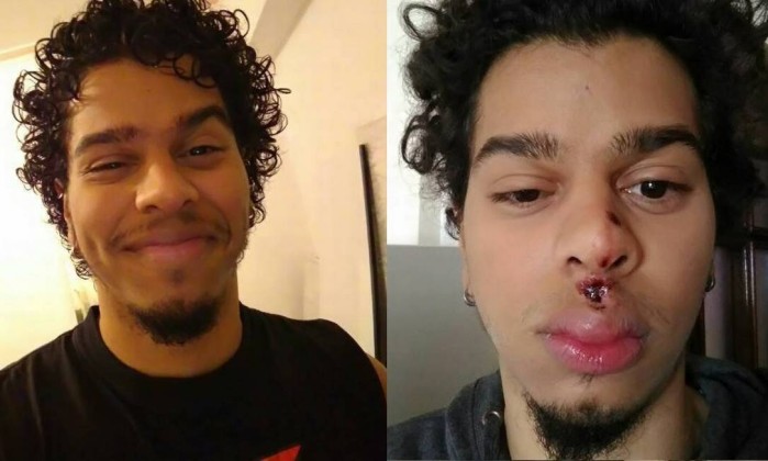 Estudante brasileiro diz que foi vítima de violência xenófoba em Portugal  Leia mais sobre esse assunto em http://oglobo.globo.com/brasil/estudante-brasileiro-diz-que-foi-vitima-de-violencia-xenofoba-em-portugal-20994565#ixzz4a7wYNCRl  © 1996 – 2017. Todos direitos reservados a Infoglobo Comunicação e Participações S.A. Este material não pode ser publicado, transmitido por broadcast, reescrito ou redistribuído sem autorização.