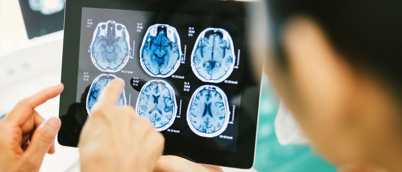 Médicos pedem mais exames no Brasil do que em países ricos