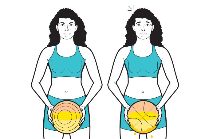 O elo entre incontinência urinária e inatividade