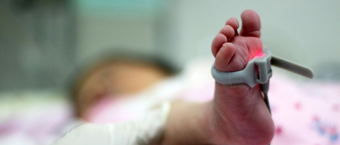 Saúde quer zerar fila de cirurgia para bebês cardiopatas