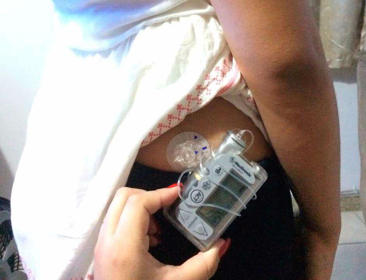 Jovem com diabetes é impedida de fazer Enem usando bomba eletrônica de insulina na Bahia