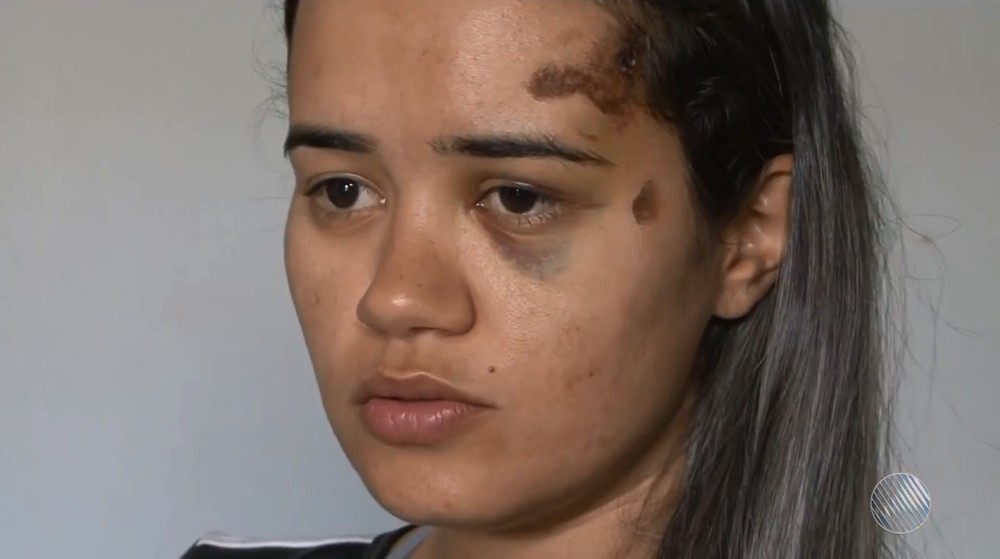 Jovem denuncia ter sido espancada por ex que não aceitava fim de namoro na BA: ‘Me deu rasteira e eu desacordei’