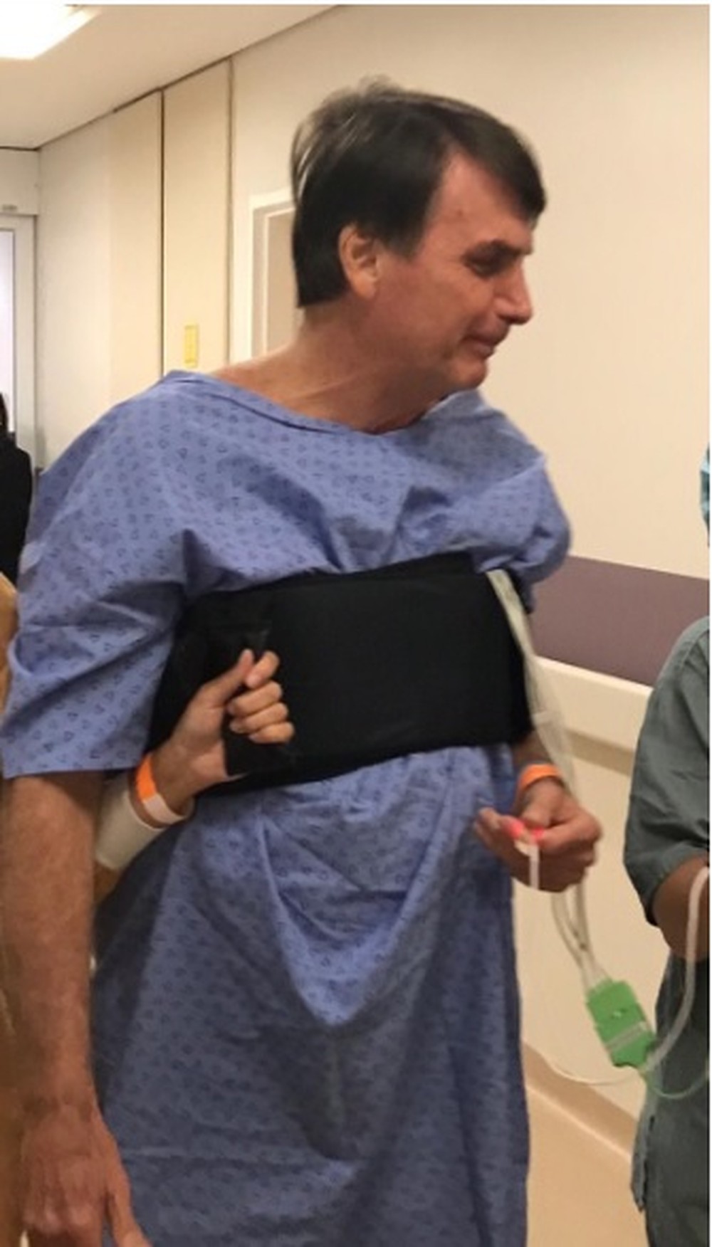 Bolsonaro passa por tomografia e deve permanecer com dieta cremosa nesta segunda