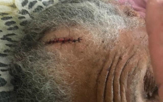 Neto é preso suspeito de agredir a avó de 79 anos com golpe de machado na cabeça na Bahia