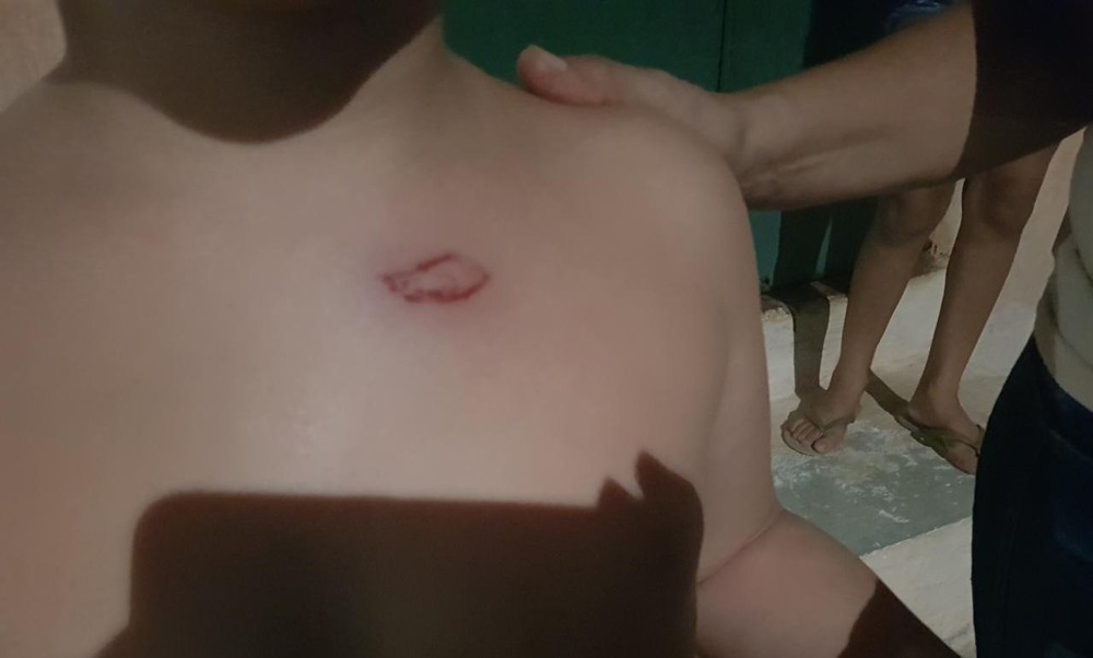 Assaltante se recusa a receber iPhone devido rastreamento, atira contra vítima e atinge adolescente e criança em Fortaleza