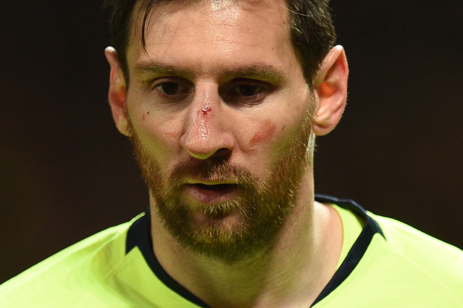 Smalling não se desculpa por fazer Messi sangrar e vira meme; Argentino passa por exames