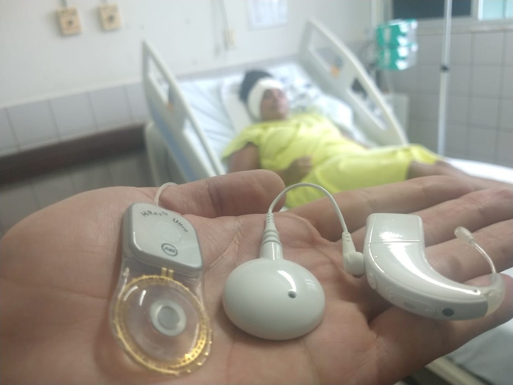 Primeiro implante de ouvido biônico do Hospital Universitário é feito em paciente após 12 anos de perda da audição