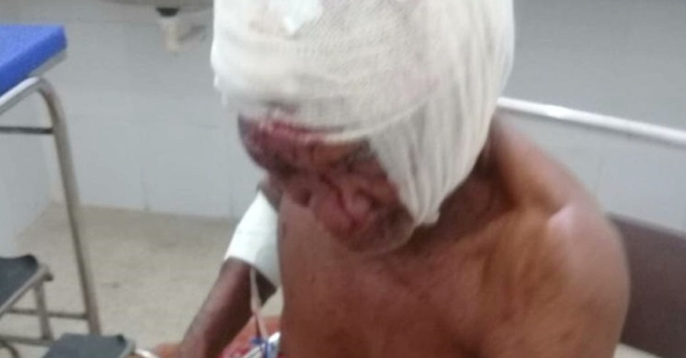 Idoso de 76 anos é agredido e esfaqueado dentro de casa no MA