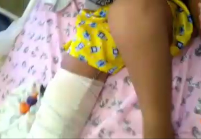 Vídeo: Criança tem perna enfaixada com papelão em Hospital de Caririaçu, denuncia vereador