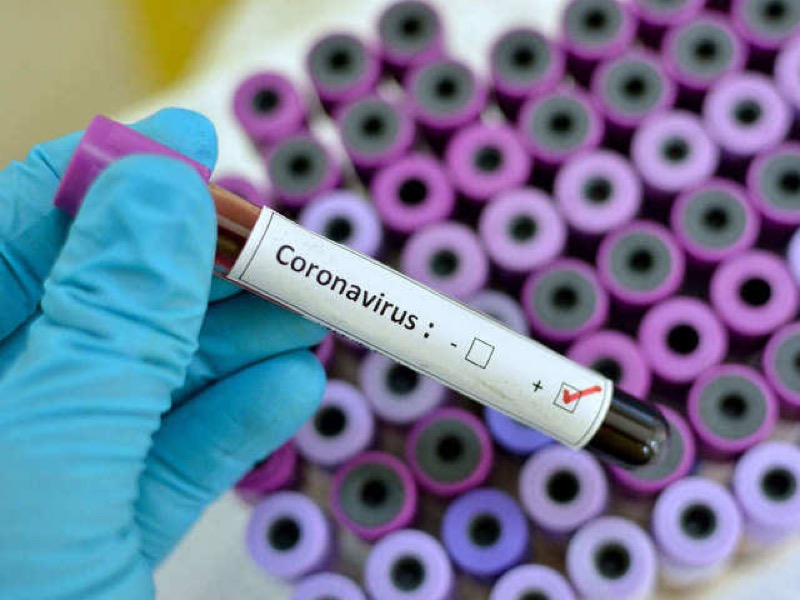 Veja quantidade de casos confirmados no Ceará, cidades e óbitos