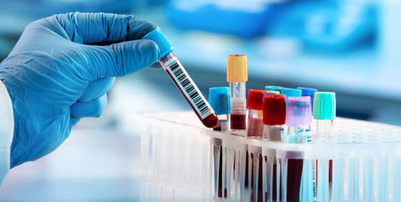 Nota de esclarecimento sobre os exames laboratoriais realizados no Lacen