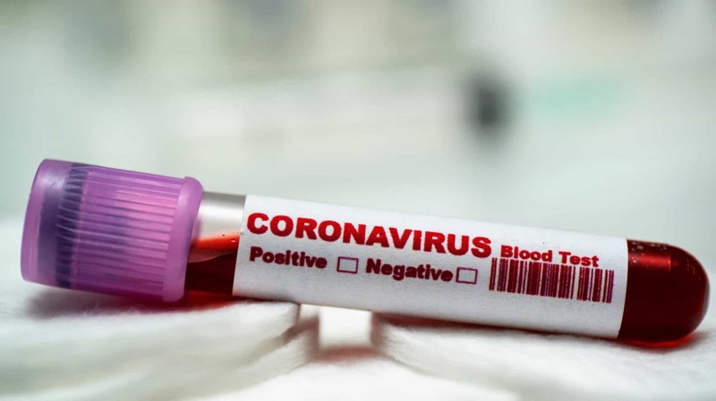 Ao menos 172 municípios do país já têm casos confirmados de coronavírus