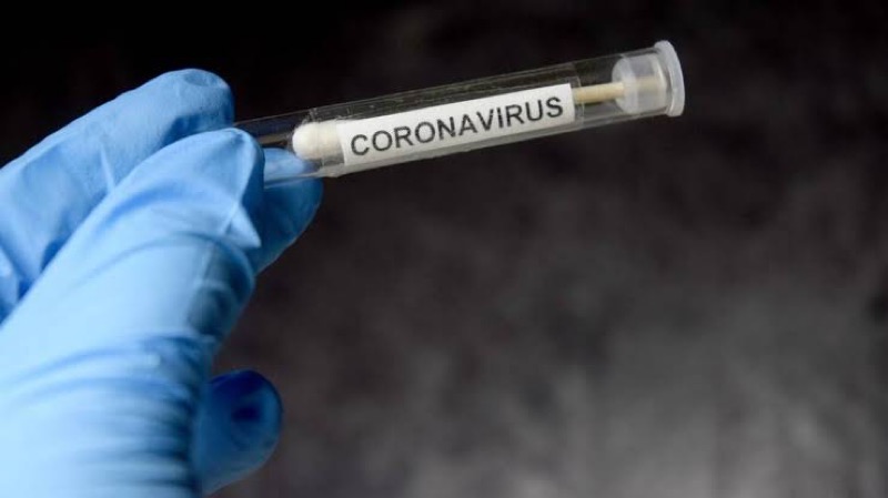 Ceará registra 12.310 casos confirmados do novo coronavírus; Já são 849 mortes pela Covid-19