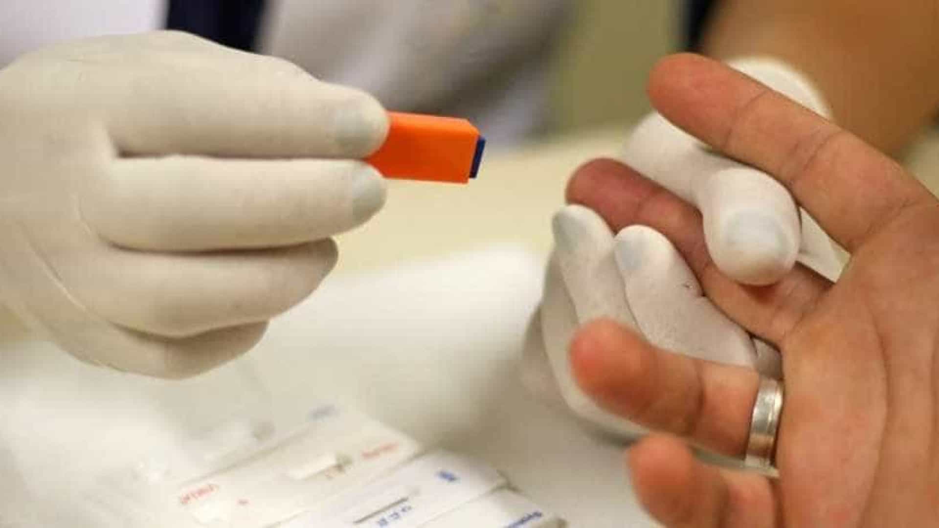 Anvisa discute liberar aplicação de teste para covid-19 em farmácias