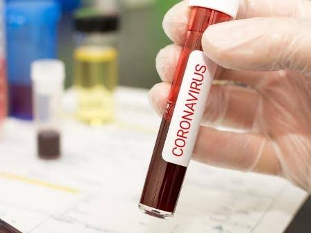 Ceará registra 2.161 mortes por Covid-19 e 31.413 casos confirmados do novo coronavírus