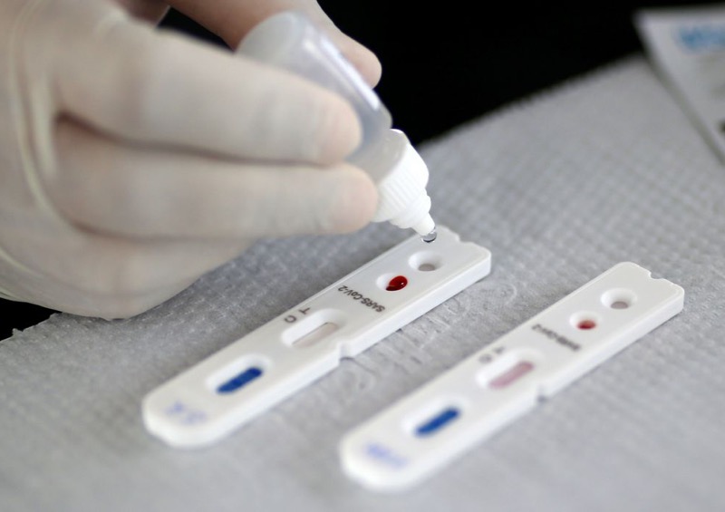 Pesquisadores desenvolvem testes rápidos para detectar coronavírus