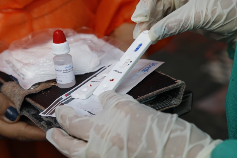 Ceará possui 234 mil testes rápidos para Covid-19, maior parte destinada ao interior