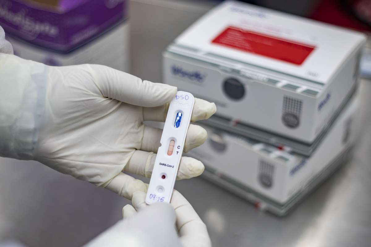 MPCE reforça que Planos de Saúde devem cobrir exames e tratamento da Covid-19