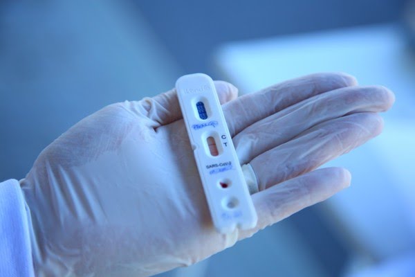 Ceará ultrapassa 4.100 mortes e 66 mil casos confirmados do novo coronavírus