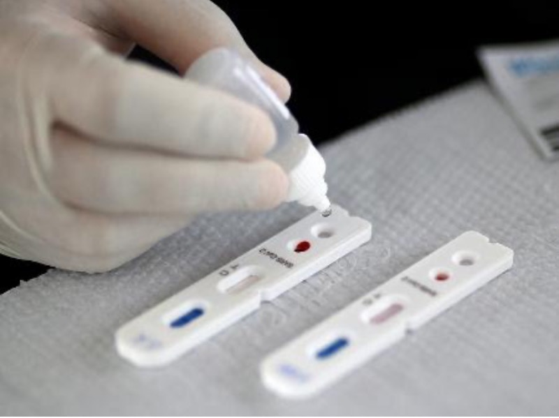 Teste para Covid aprovado pela ANS é disponibilizado pelo Hapvida