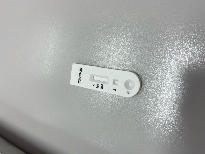 Barbalha amplia o sistema de testagem para Covid-19