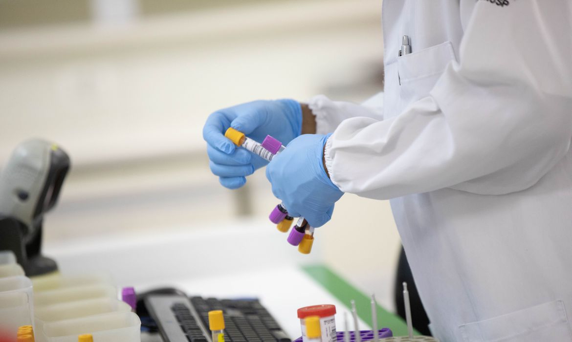 Hospital em SP separa laboratório para casos de reinfecção de covid-19