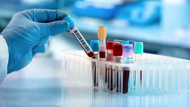 Covid-19: Brasil tem 713 óbitos e 28.523 novos casos em 24h