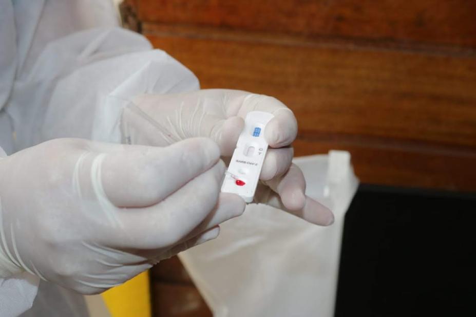 Covid-19: Brasil tem 157,9 mil mortes e 5,43 milhões de casos