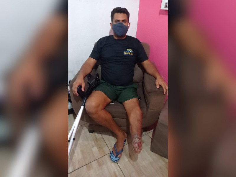 Crato: ex- garçom que teve perna amputada pede ajuda para realizar cirurgia de emergência