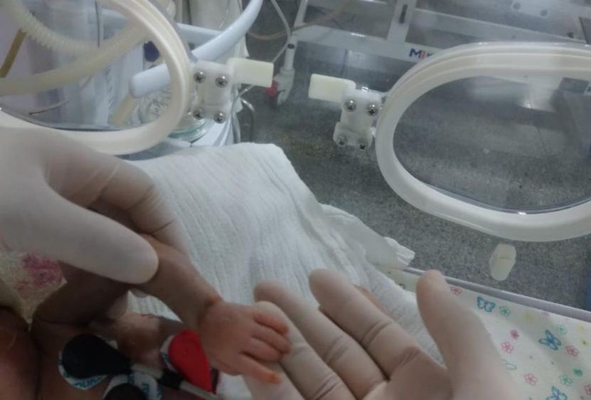 Bebê com menos de um quilo é operado na UTI pediátrica do Hospital do Coração do Cariri e passa bem