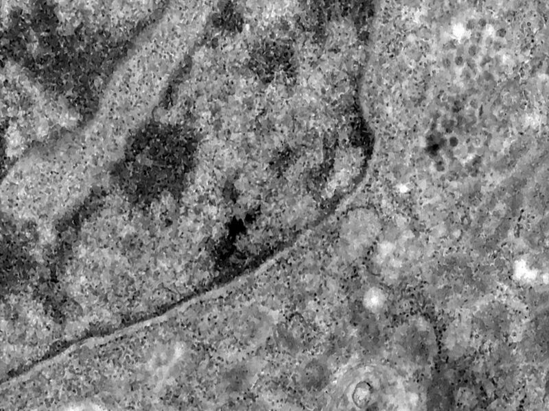 Covid-19: estudo aponta aumento de bactérias resistentes em UTIs