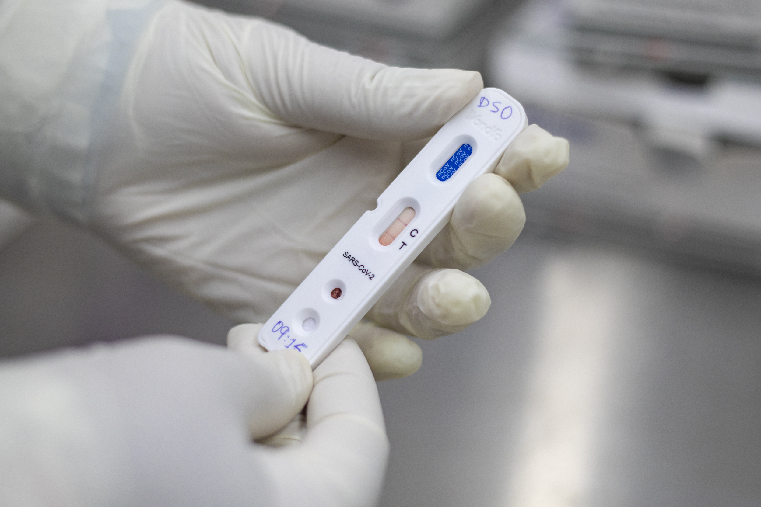 Covid-19: Brasil registra 3,8 mil novos casos e 32 óbitos em 24 horas