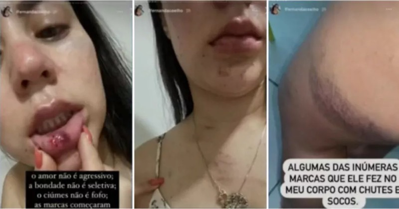 Após ser espancada por ex-namorado em Barbalha,  jovem expõe caso nas redes sociais e incentiva outras mulheres a denunciar