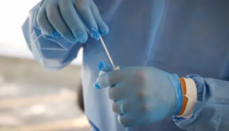 Brasil registra mais de 24 mil novos casos e bate 23 milhões de infecções de Covid