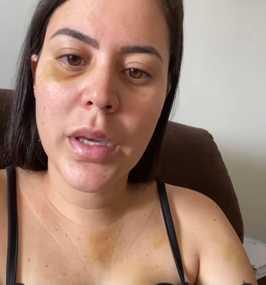 Polícia Civil de Barbalha investiga violência contra mulher que acusou ex-namorado nas redes sociais