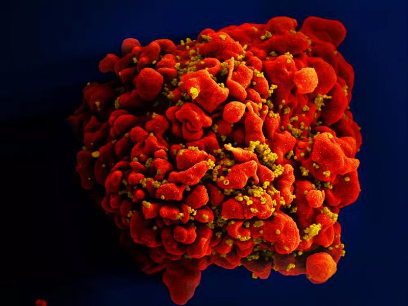 Remédio contra câncer pode ajudar a eliminar vírus HIV que fica latente nas células, aponta estudo