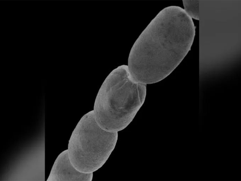 Maior bactéria do mundo é descoberta e cientistas comparam a forma de cílio humano