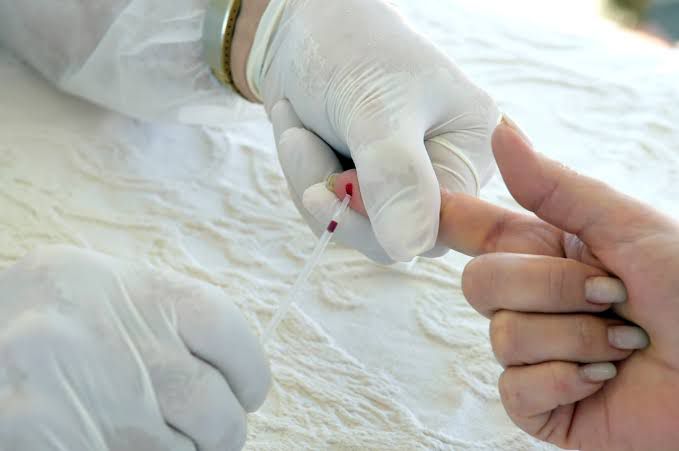 Com alta de casos de Covid-19, Crato cria novo Centro de Testagem