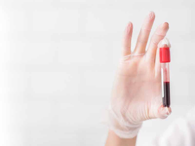 Cientistas avançam no desenvolvimento de diagnóstico de câncer de próstata por exame de sangue