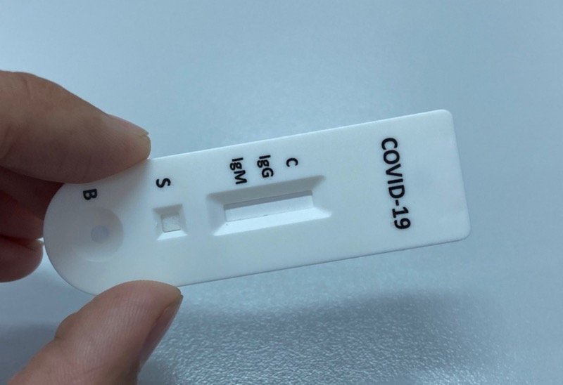 Testes positivos para Covid-19 caem oito pontos percentuais em uma semana