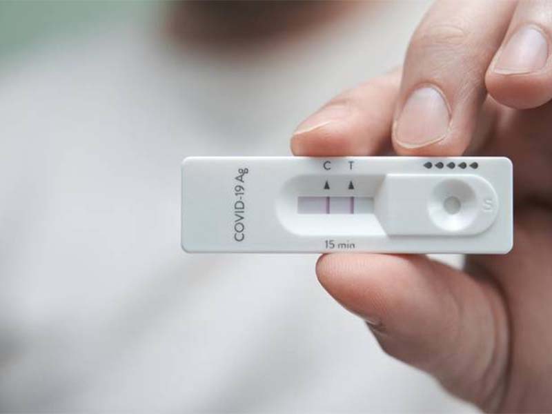 Teste para Covid-19 passa a ser disponibilizado em postos de saúde no Crato