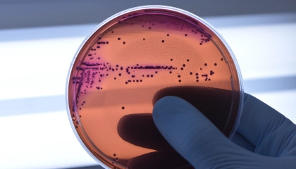 Medicamento reduz capacidade de bactérias de desenvolver resistência a antibióticos