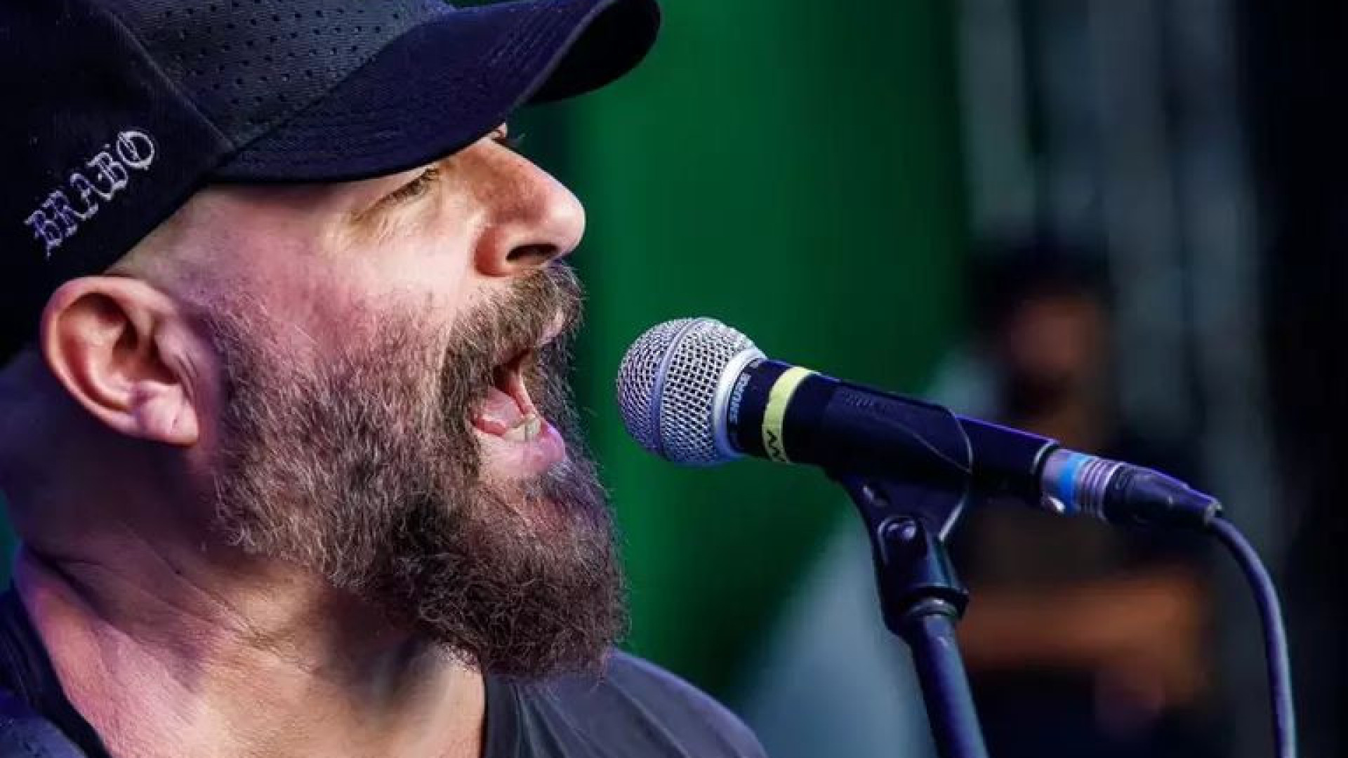 Músico Mingau do Ultraje a Rigor passa por nova cirurgia no crânio em São Paulo
