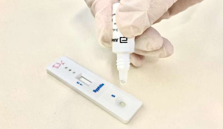 Crato realiza ação de combate à sífilis com oferta de testes rápidos e serviços de saúde