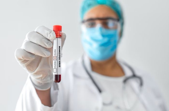 Mpox: OMS aprova primeira vacina para uso emergencial em crianças