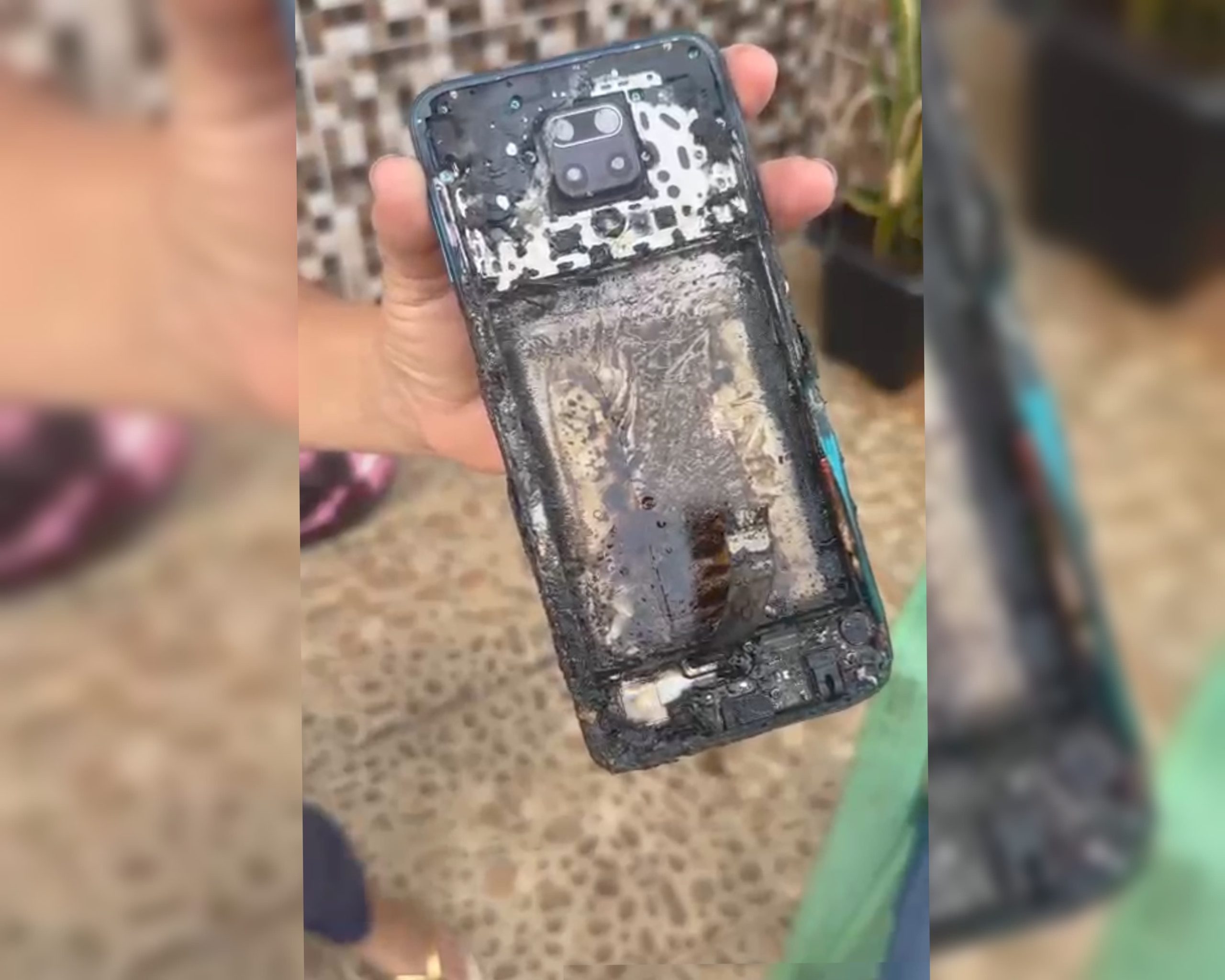 Mulher sofre queimaduras após celular pegar fogo no bolso, em Crato