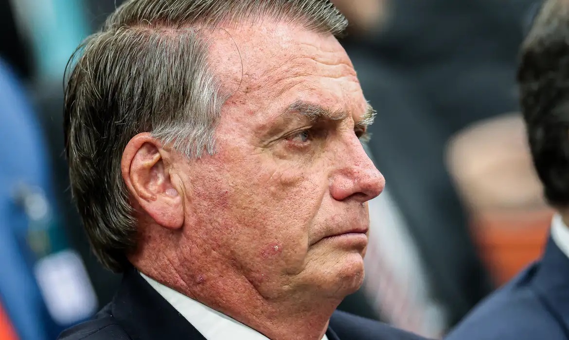 Bolsonaro apresenta piora clínica e vai passar por novos exames