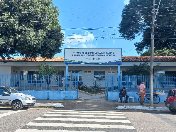 Centro de Dermatologia de Juazeiro do Norte funcionará em novo expediente