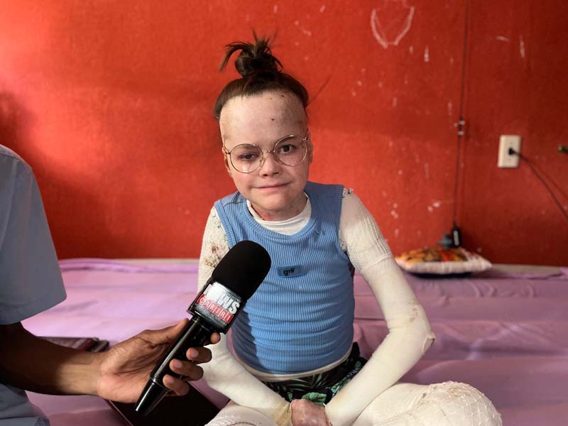 Jovem de 17 anos com doença rara que provoca feridas na pele pede ajuda para arrecadar R$ 300 mil e realizar cirurgias